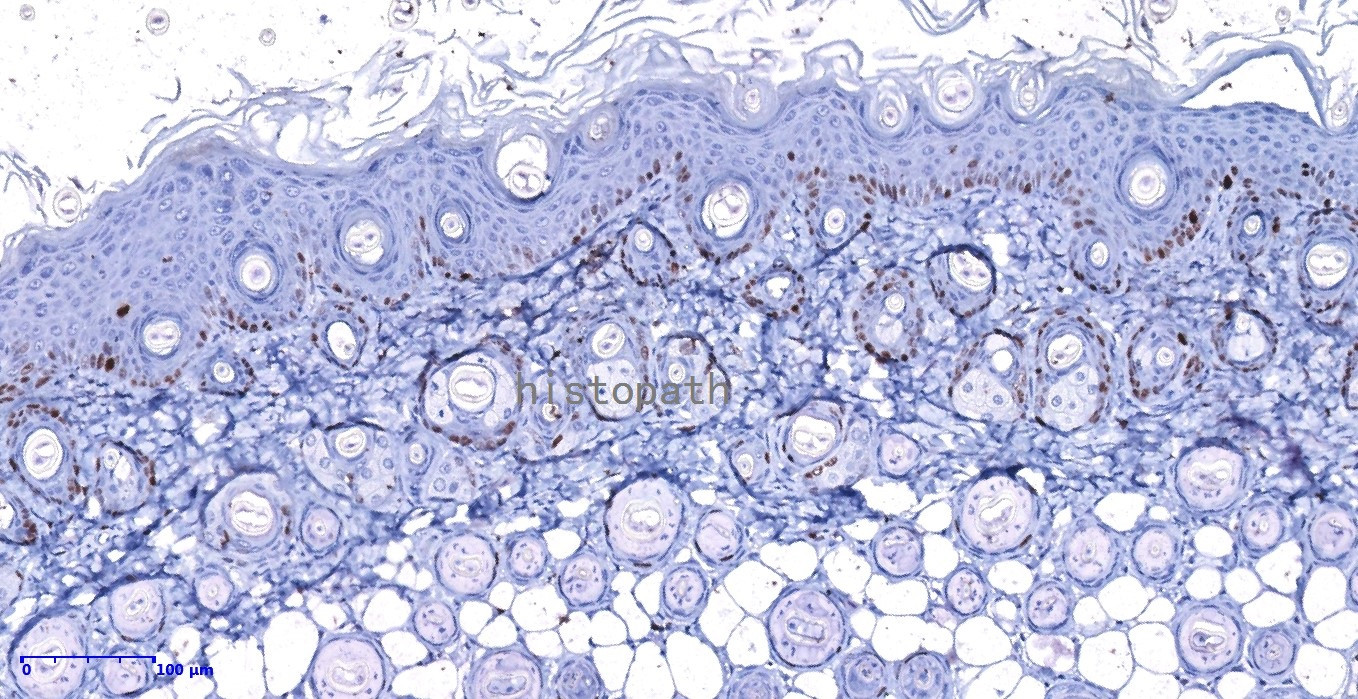 皮肤ki67免疫组化.jpg