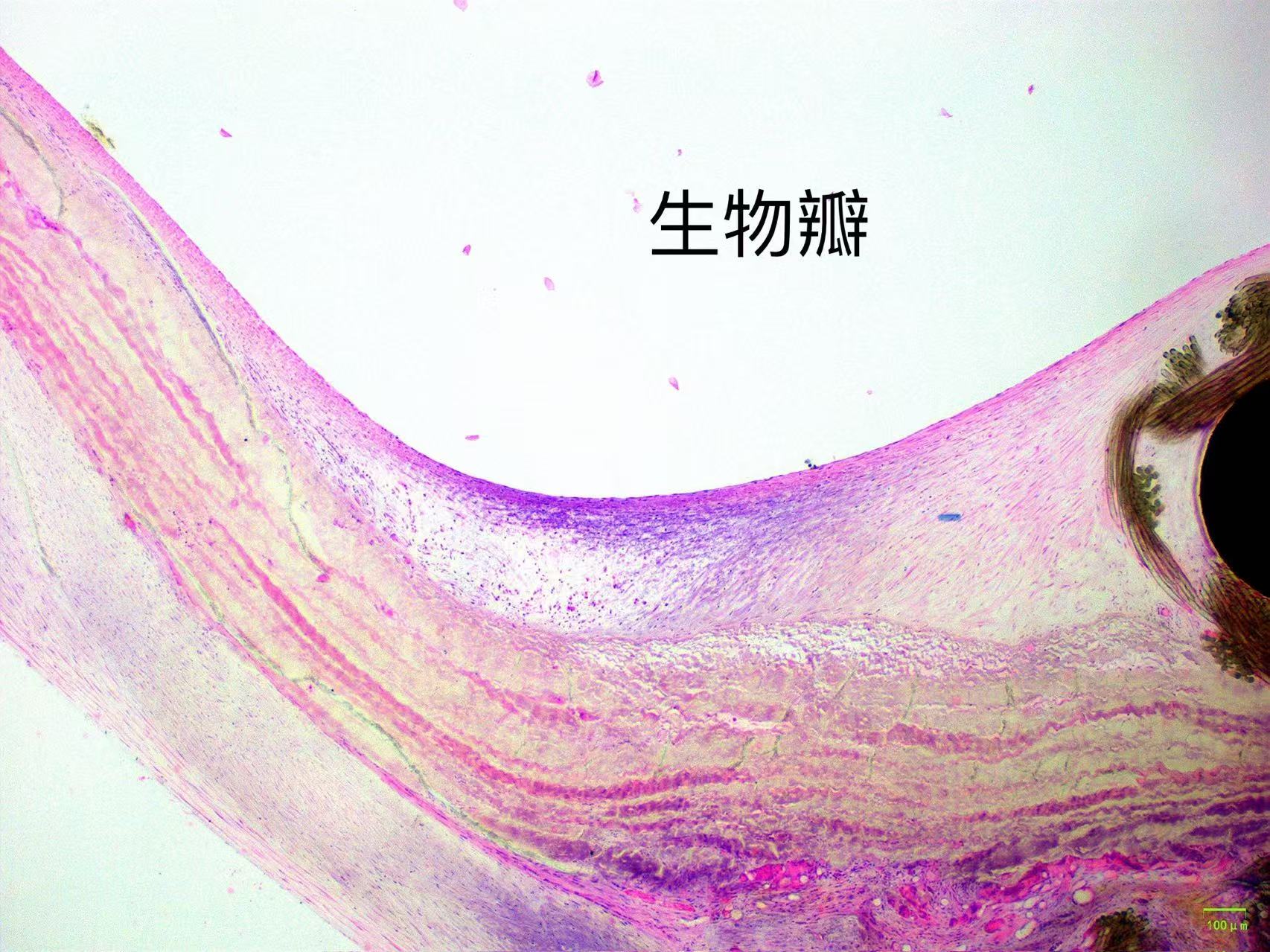 主动脉瓣