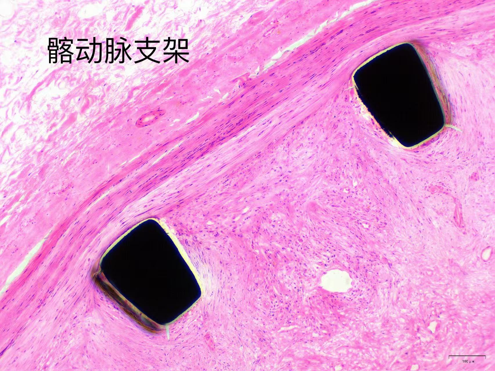 其他支架